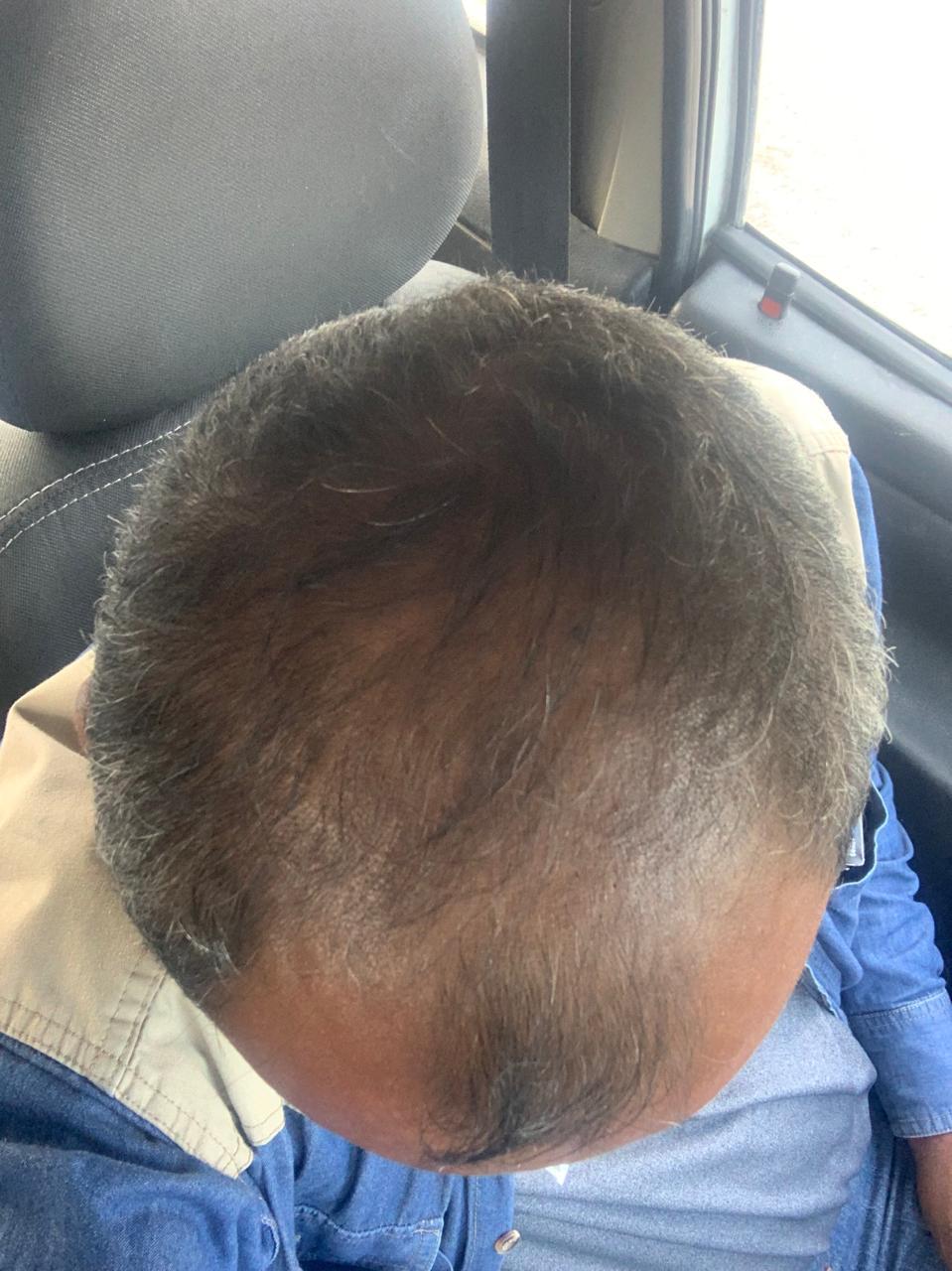 SHAMPO SÓLIDO NATURAL ANTICAIDA DE CABELLO