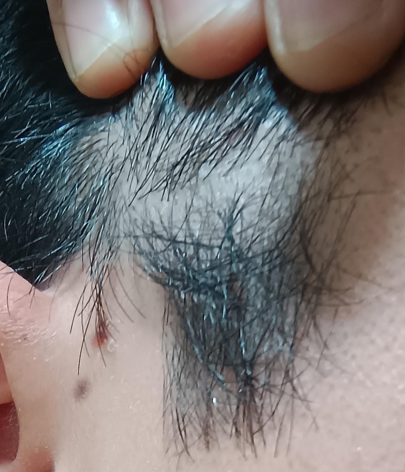 Shampo Sólido Anticaspa-Psoriasis Cinnafix